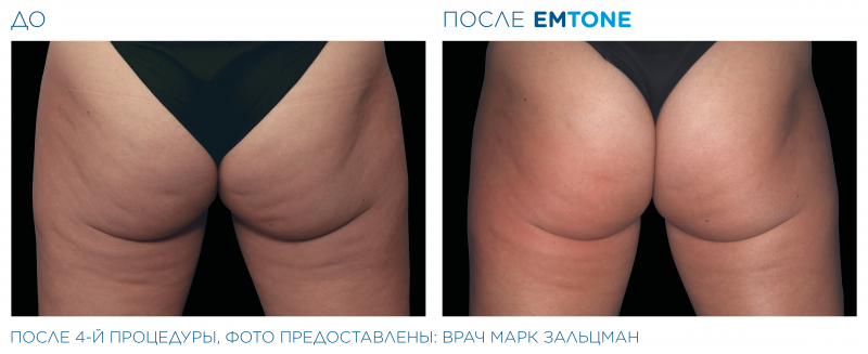 emtone_pic_ba-card-female-buttock-001_ru100.png-800x327.png emtone_pic_ba-card-female-buttock-001_ru100.png-800x327.png