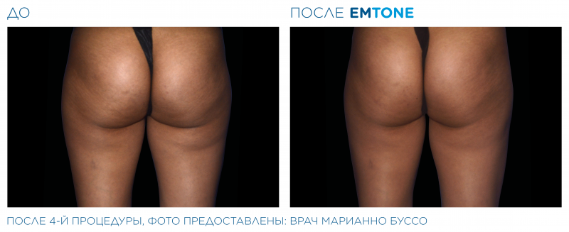 emtone_pic_ba-card-female-buttock-006_ru100.png-800x327.png emtone_pic_ba-card-female-buttock-006_ru100.png-800x327.png